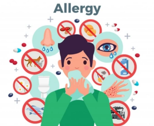 Alergi